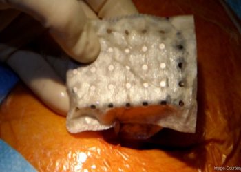 Elutia’s Game-Changing Tech Has Boston Scientific’s Full Attention— Is A Bigger Deal Coming Next? cover